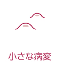 小さな病変