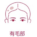 有毛部